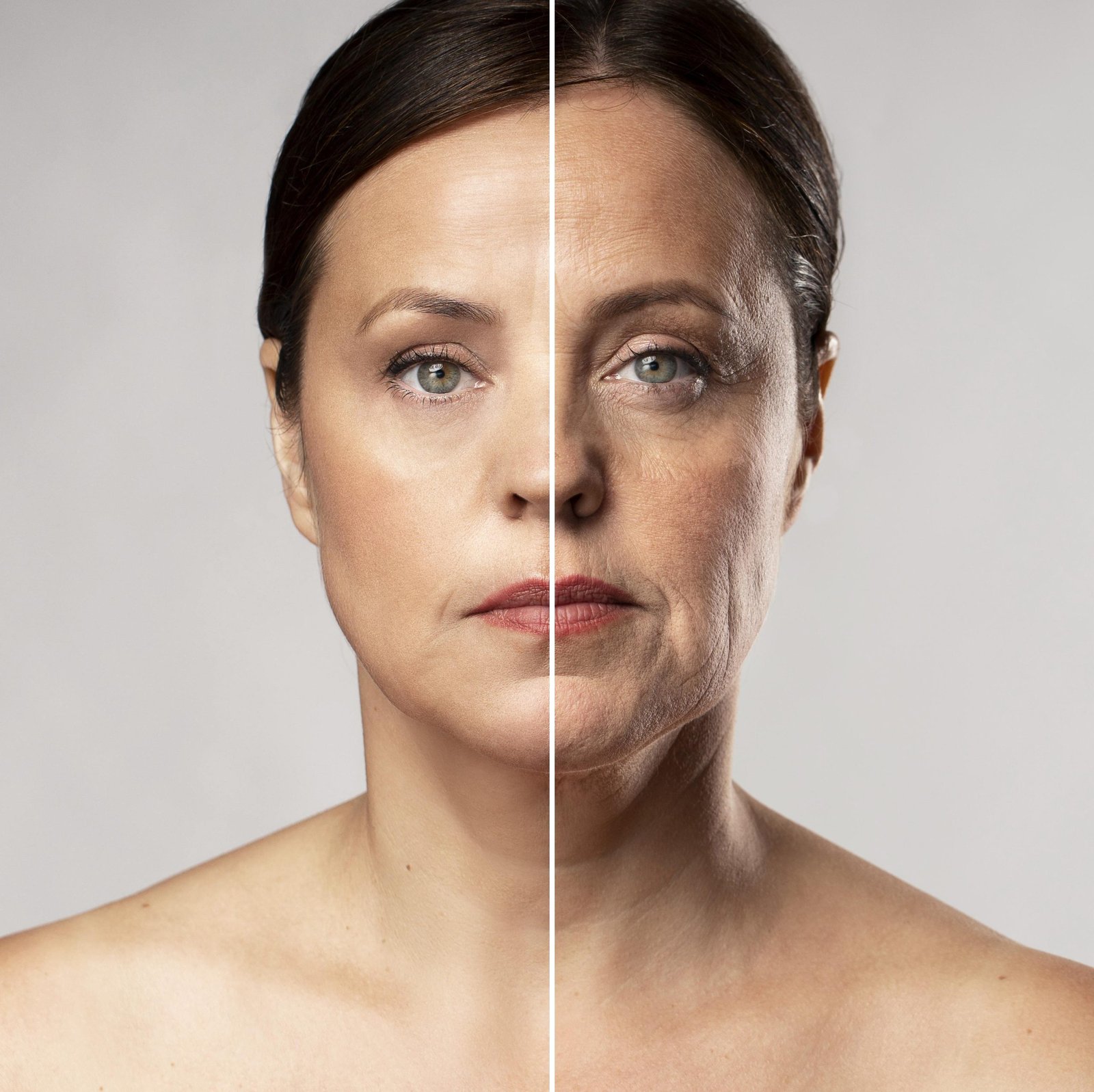 Bioestimuladores y Biorevitalizantes