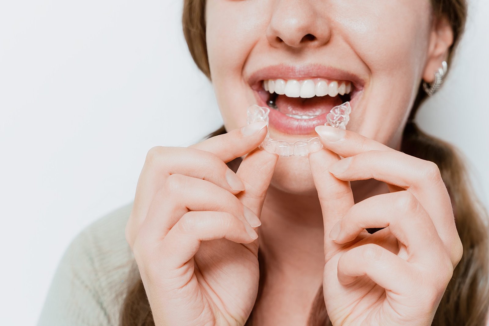 Alineadores Invisalign